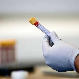 تشترك متلازمة التهاب الأجهزة ببعض الأعراض مع مرض كاواساكي