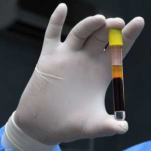 جهاز المناعة يلعب دورا كبيرا في مكافحة فيروس كورونا