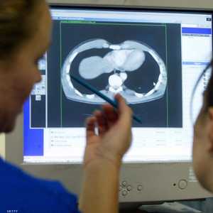 أرشيفية.. الأميبا النادرة تتسبب بتآكل الدماغ