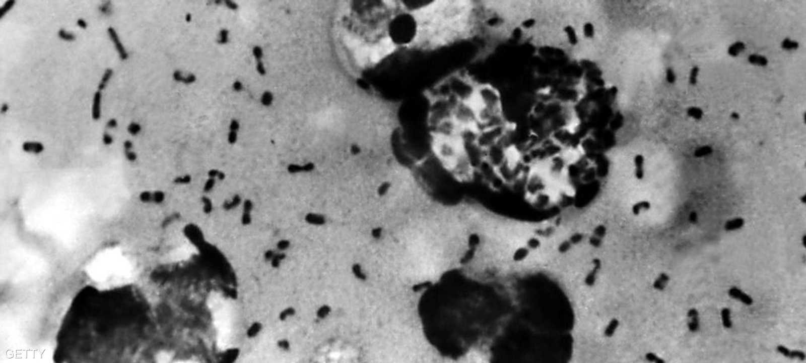 الطاعون الدبلي.. مخاوف واسعة