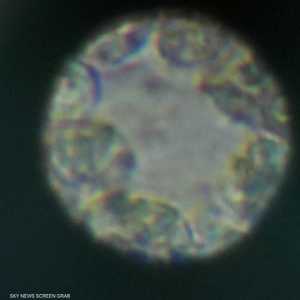 فيروس كورونا.. ما أصله ومتى ينتهي؟