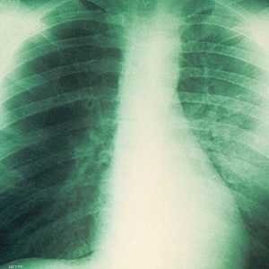 الدواء المصري "انهالكس" يعالج أمراض تنفسية