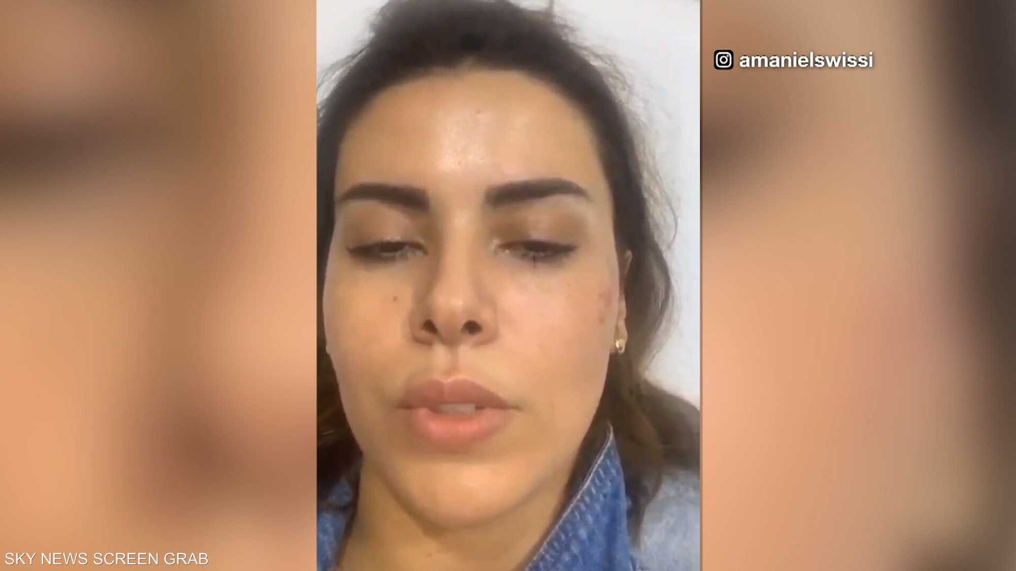 أماني السويسي تشعل مواقع التواصل بعد إعلانها تعرضها للضرب