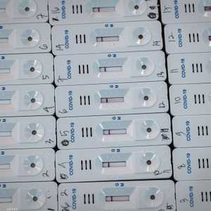 عينات لفحوصات الأجسام المضادة ضد فيروس كورونا