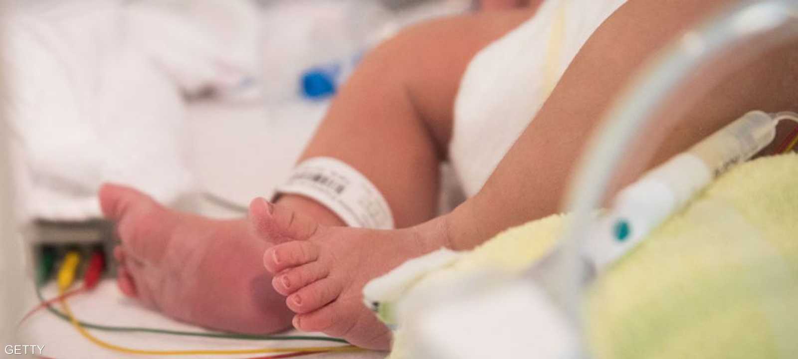 الولادة تمت عن طريق عملية قيصرية.. أرشيفية