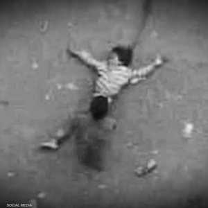 الطفلة تلقت رصاصة في رأسها