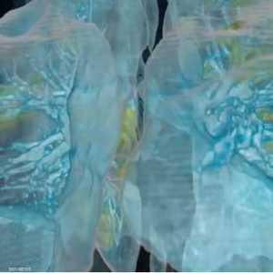 الرئة من أكثر أعضاء الجسم تضررا من كورونا