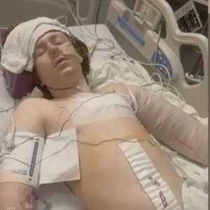 الطفل في حالة خطيرة