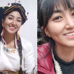 لامو تعرضت للحرق.