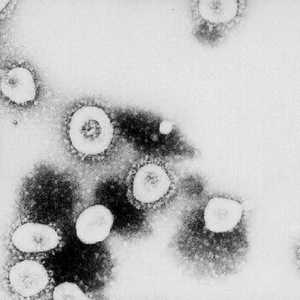 صورة مجهرية لفيروس كورونا المستجد