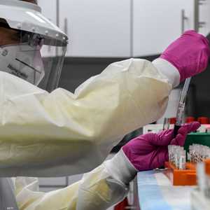 تطوير اللقاح وصل إلى مرحلة متقدمة