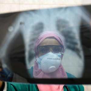 الحالة استدعت وضع الرجل على جهاز تنفس اصطناعي - صورة أرشيفية