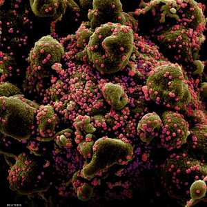 جزيئات فيروس كورونا باللون الأحمر تهاجم خلية بشرية