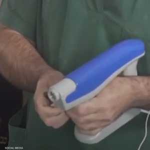 "مسدس" يوّلد جلدا بديلا