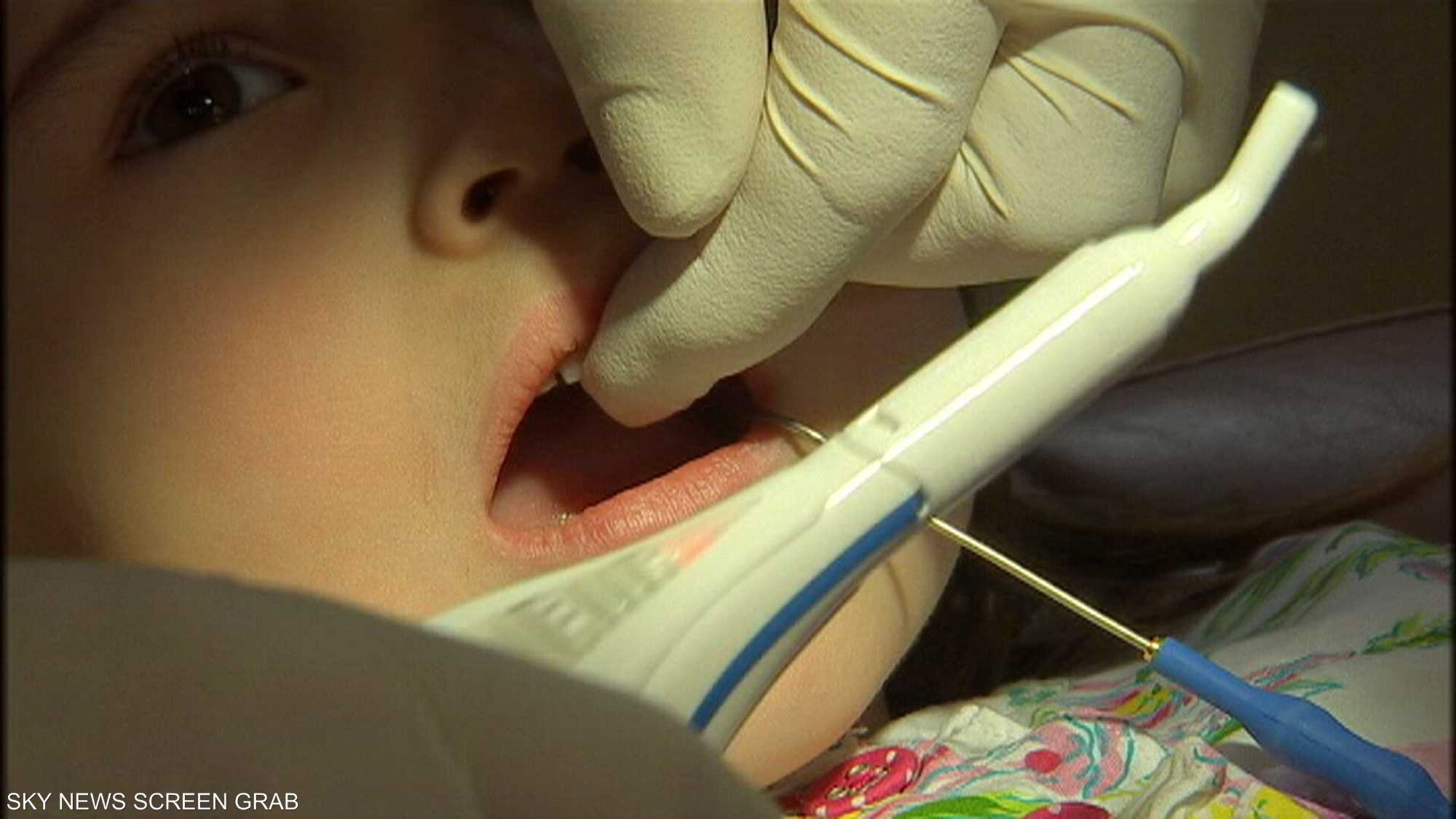 معالجة أسنان أصحاب الهمم قد تتطلب معدات خاصة