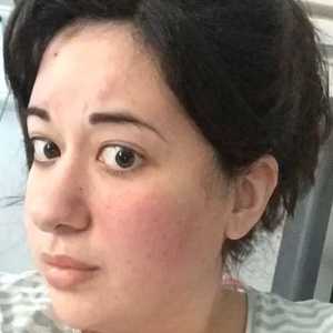 إميلي سودلو خضعت لجراحة في الدماغ بدون تخدير