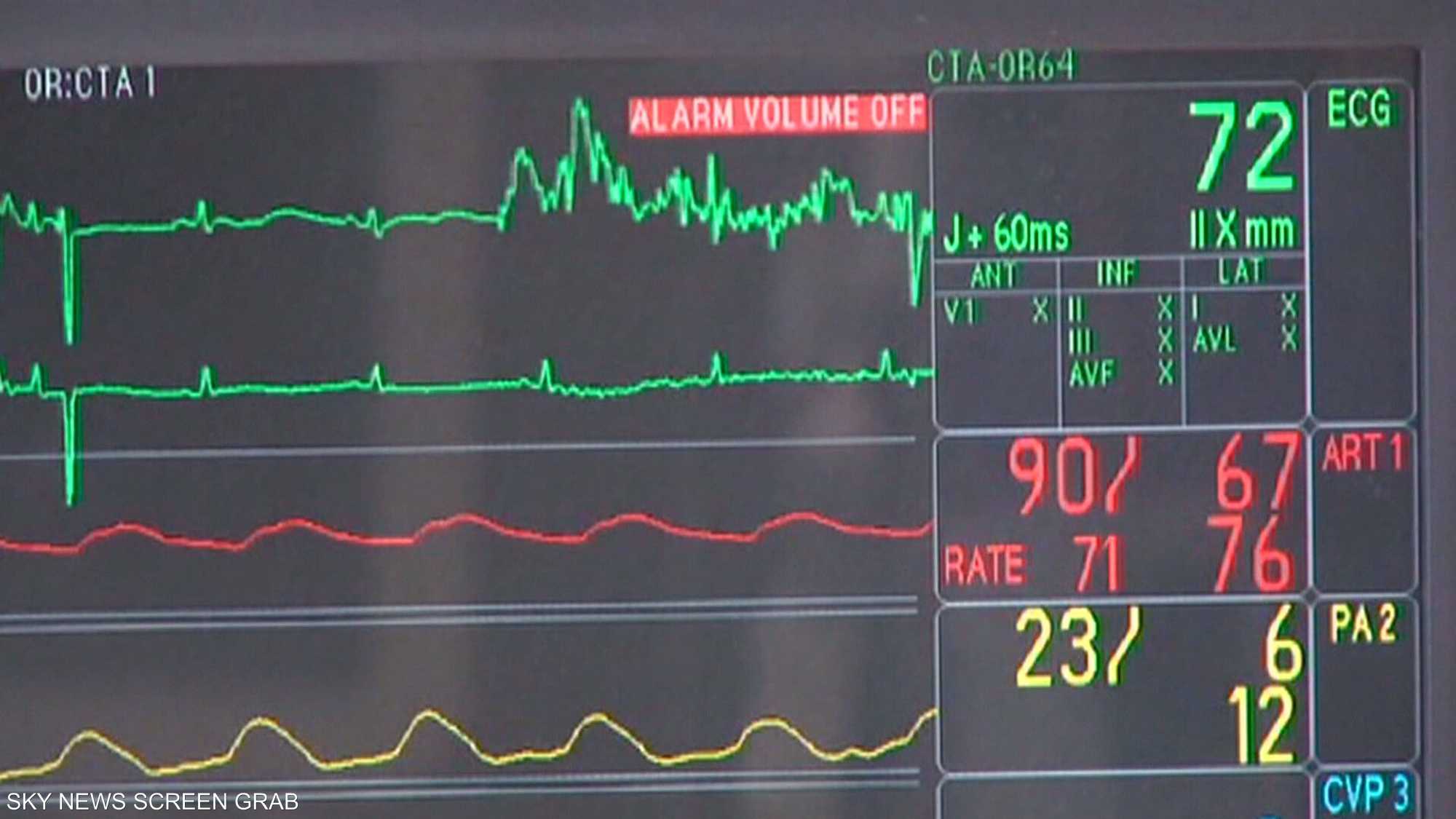 ارتفاع ضغط الدم قد يؤدي لنوبة قلبية تهدد الحياة