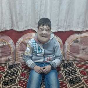 "اخلع الماسك".. معاناة طفلين مصريين مع المرض النادر