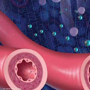 منع تشكل اللويحات في الأوعية الدموية يمنع النوبات