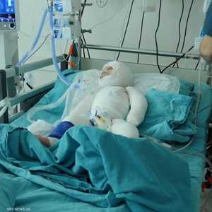 الطفلة دلال تبلغ 18 شهرا