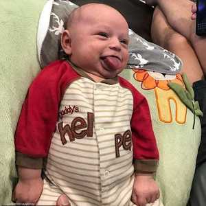 الطفل أوين بلسان أكبر من الطبيعي