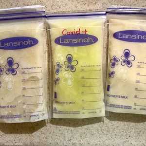 تغير لون الحليب إلى الأخضر