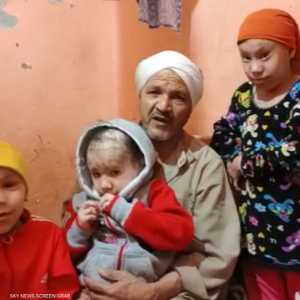 3 بنات مصريات يعشن معاناة كبيرة بسبب مرض نادر