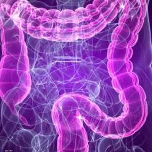 اضطراب القولون العصبي شائع بكثرة في العالم