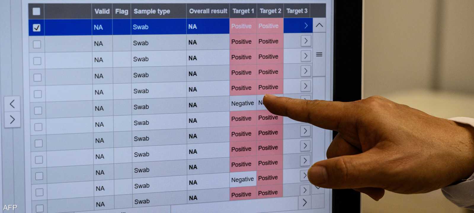 السلالة الفرنسية تراوغ فحص كورونا التقليدية