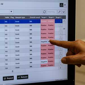 السلالة الفرنسية تراوغ فحص كورونا التقليدية