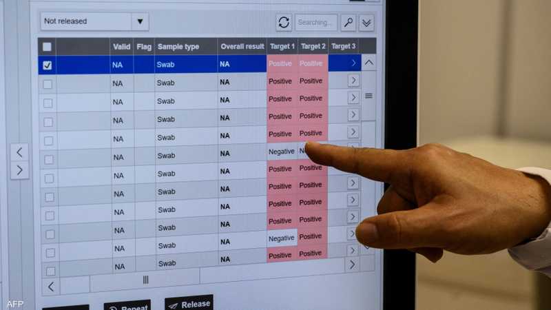 تظهر كورونا متى نتائج فحص «الصحة»: أبلغوا