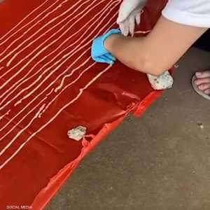 أطباء ينجحون في إنقاذ مريض من "دودة عملاقة"