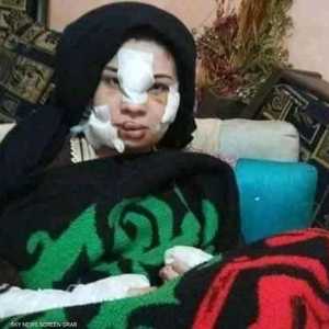 إسراء عماد بعد اعتداء زوجها
