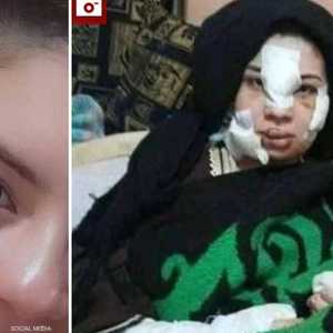 إسراء.. قبل وبعد الحادث