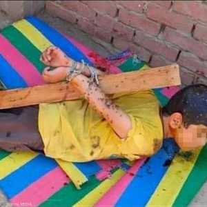 الطفل تعرض للتعنيف من قبل والده