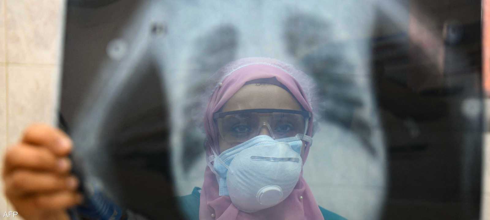 فشل الكلى من ضمن مسببات الوفاة