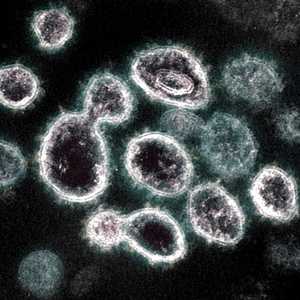 صورة مجهرية لفيروس كورونا المسبب لمرض "كوفيد-19"
