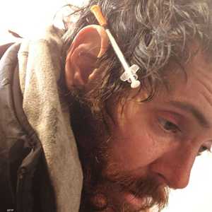 يعاني نصف المتعاطين من التهاب الكبد الوبائي