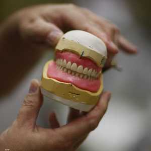 دراسة تكشف تأثير فقدان الأسنان على الصحة العقلية