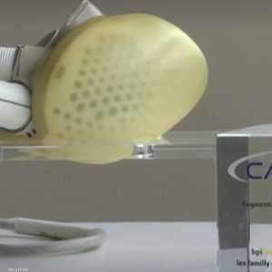 قلب اصطناعي