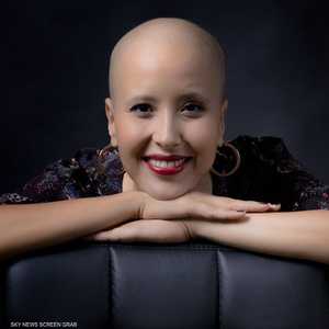 كوثر اكتشفت جمالها بعد أن فقدت شعرها