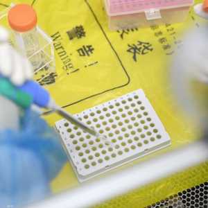 الاتهامات كانت تحوم حول مختبر ووهان في الصين