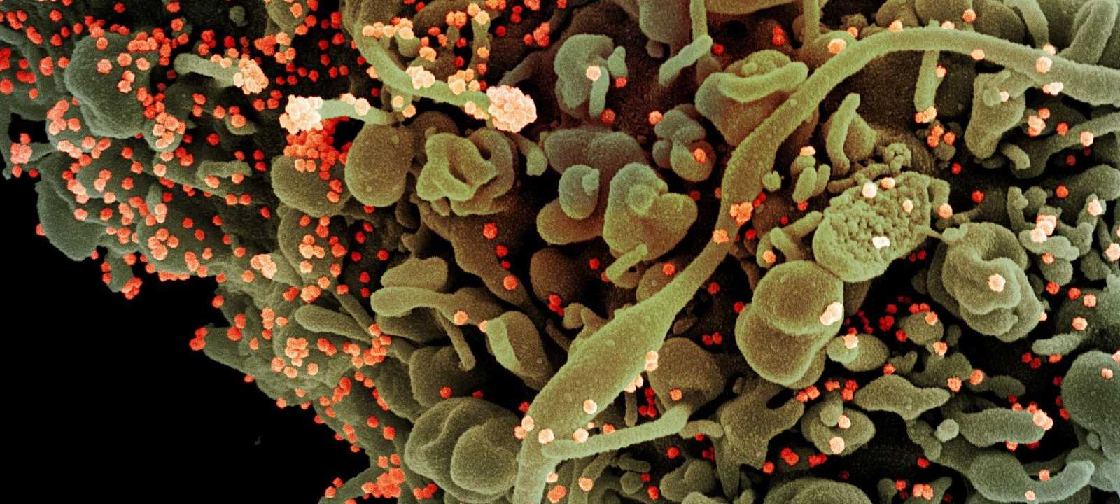 نظريات عدة تحوم حول منشأ فيروس كورونا