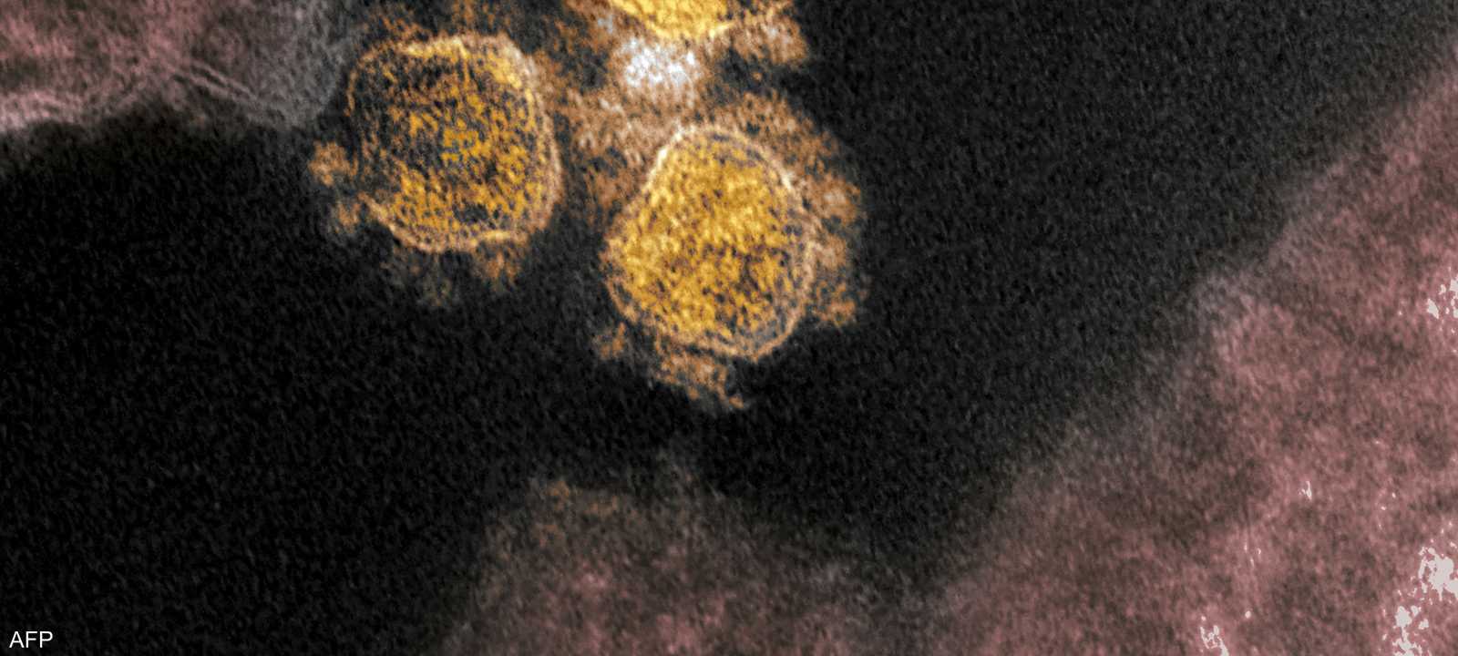 منشأ فيروس كورونا لا يزال غامضا