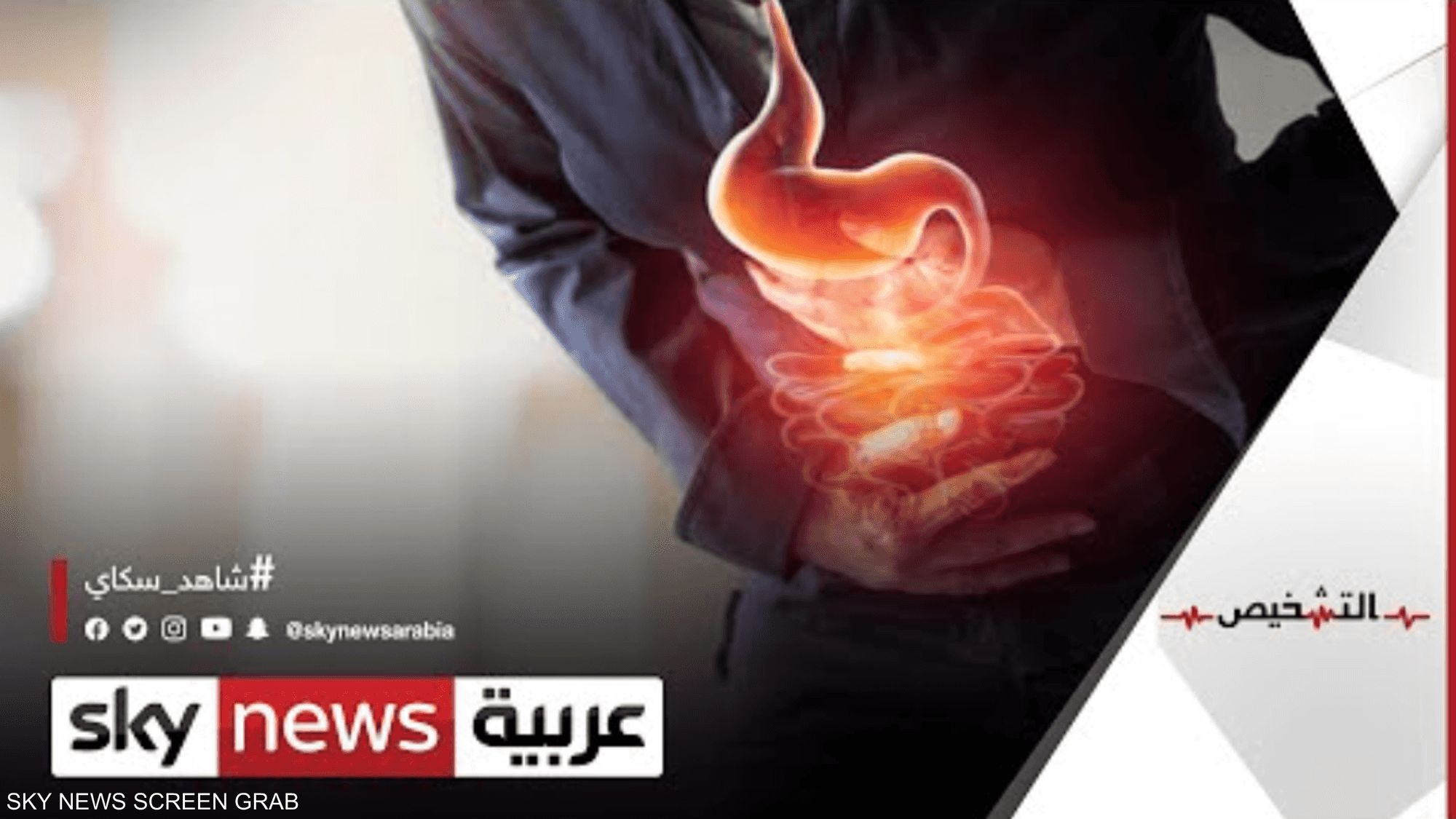 ماهي أكثر أسباب آلام المعدة عند الناس!