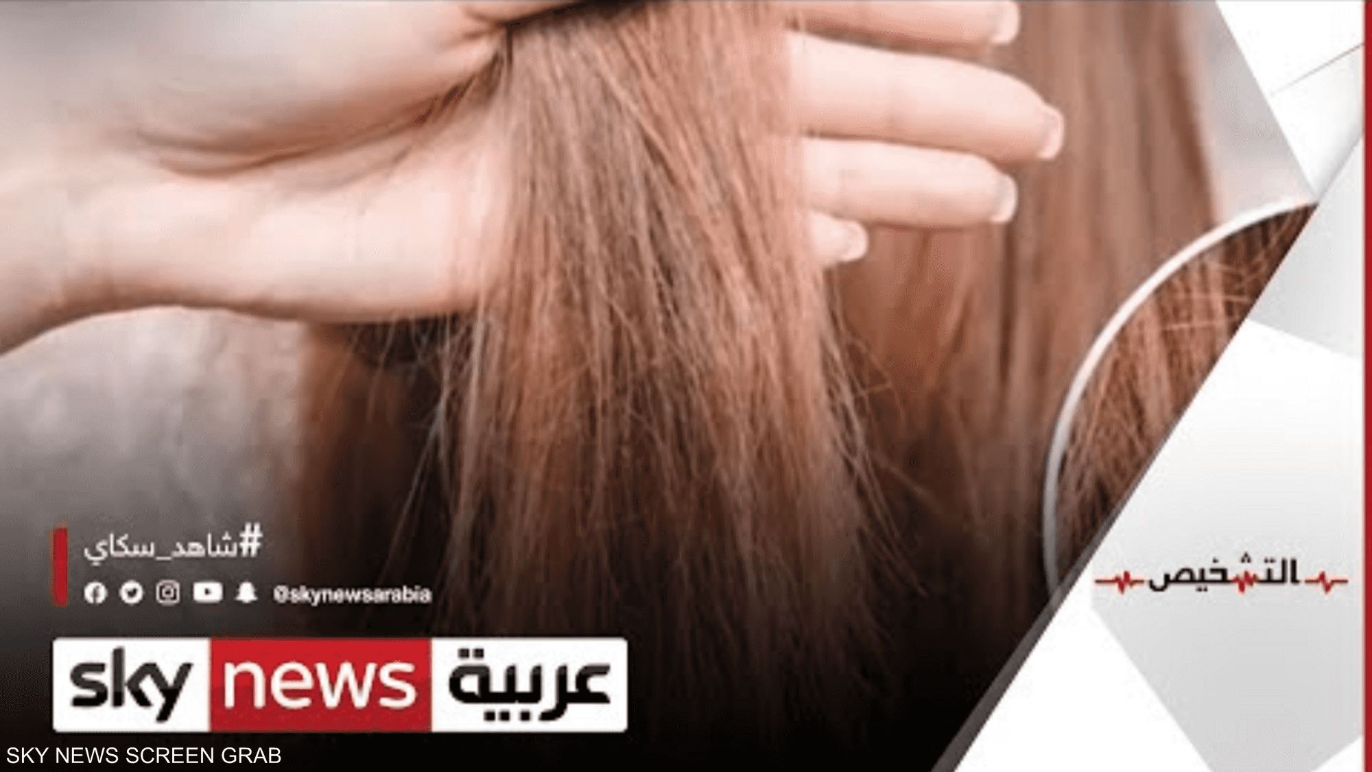 كيف يؤثر نوع الشامبو على صحة الشعر وطبيعته