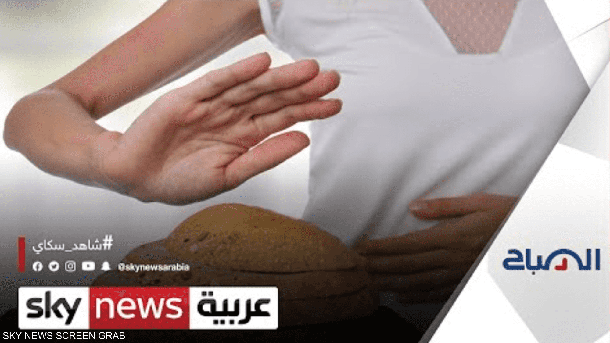 ما هي حساسية الغلوتين وأعراضها وطرق علاجها؟