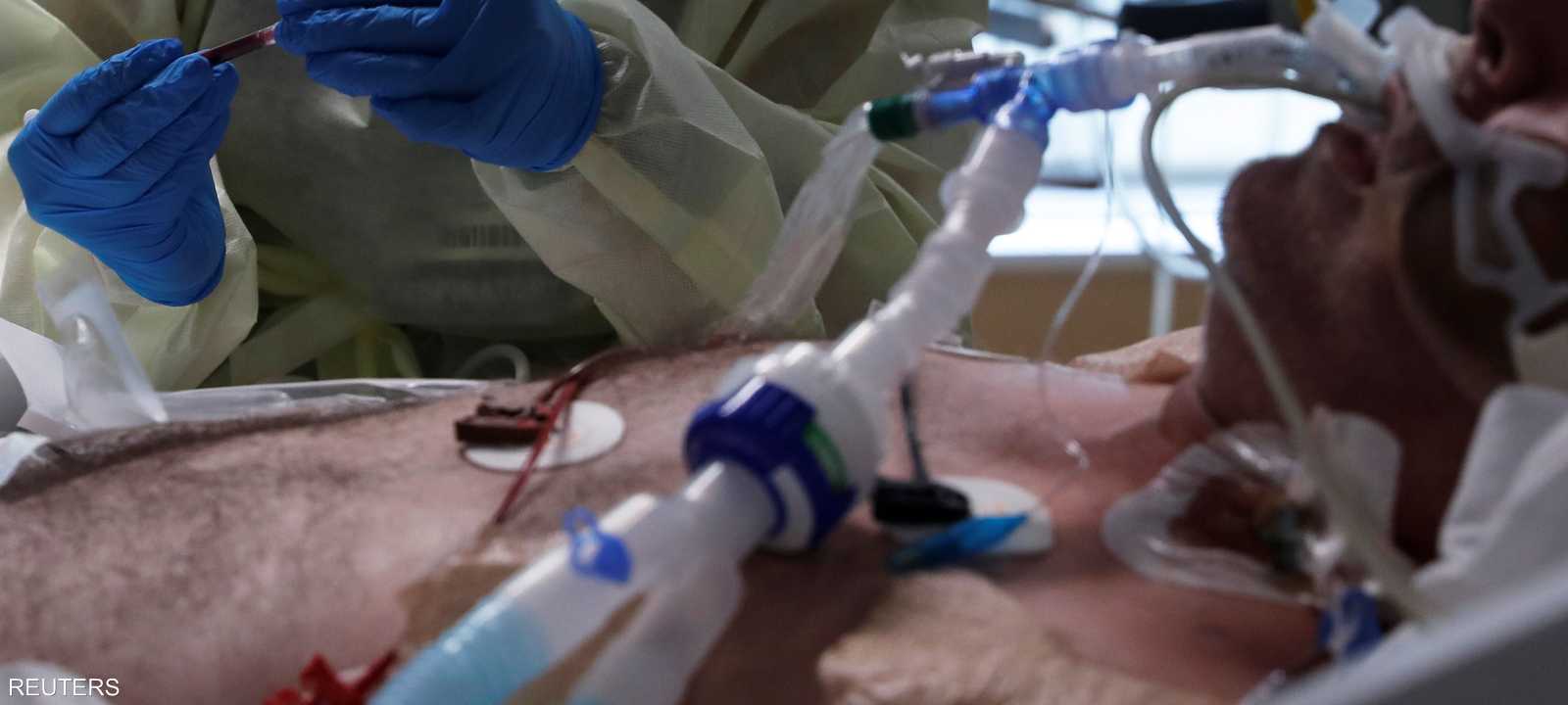 بعض أعراض كورونا قد تستمر لأشهر بعد التعافي