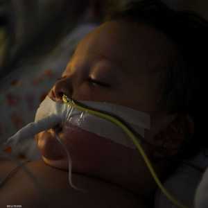 أحد الأطفال يتلقى العلاج جراء إصابته بفيروس كورونا