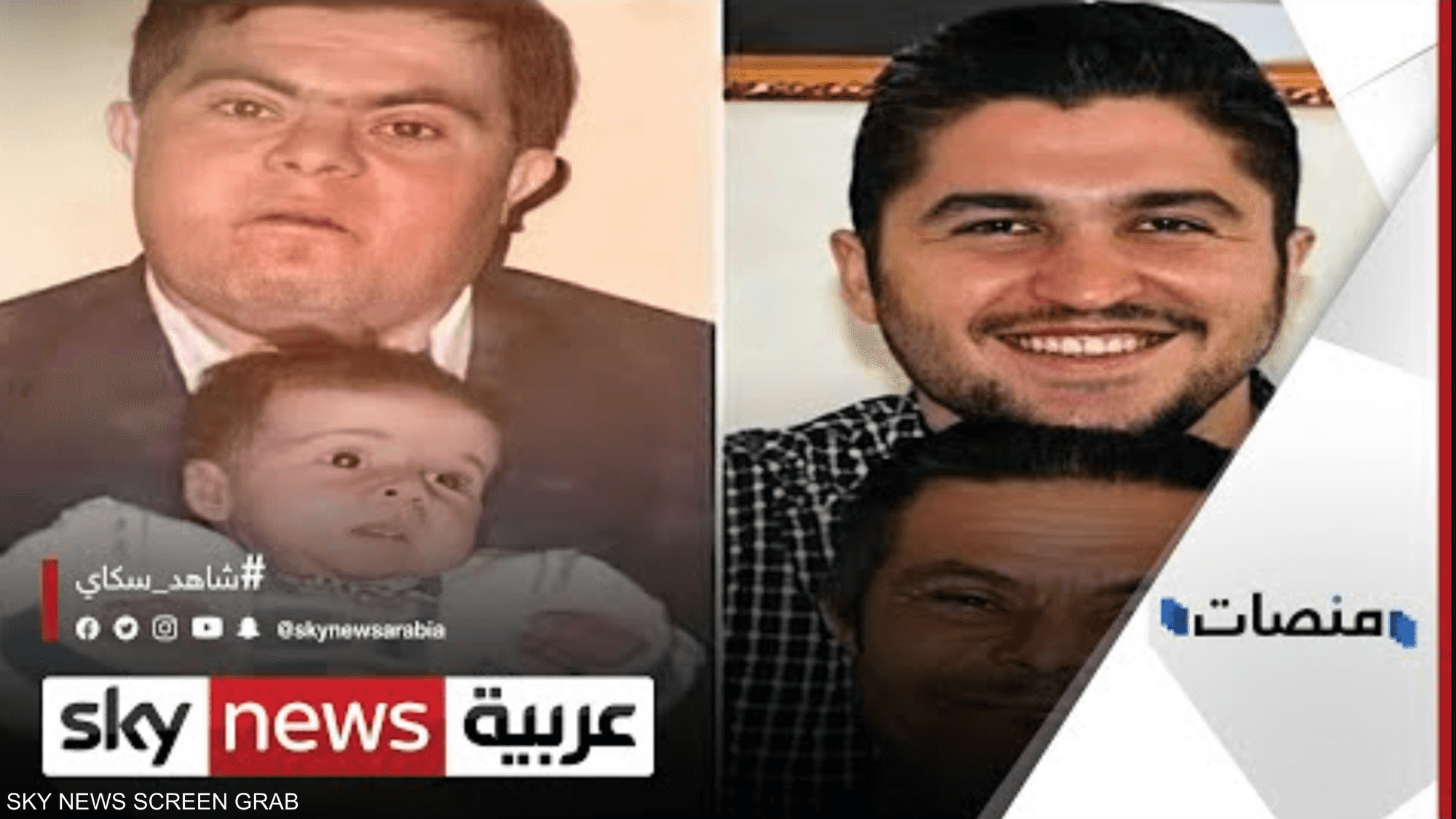 طبيب سوري يحكي عن تجربته مع والده المصاب بمتلازمة داون